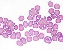 Parasite sanguin : Piroplasmose