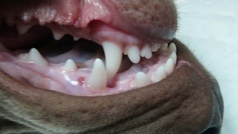 malocclusions