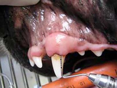 sonde parodontale 2